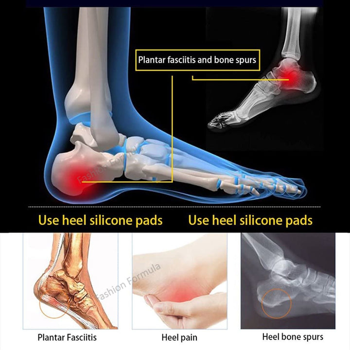 Premium Gel Heel Cups Cushion Pad - Fashion Formula