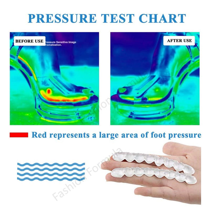 Premium Anti-Skid Forefoot Support Gel Pad - Fashion Formula